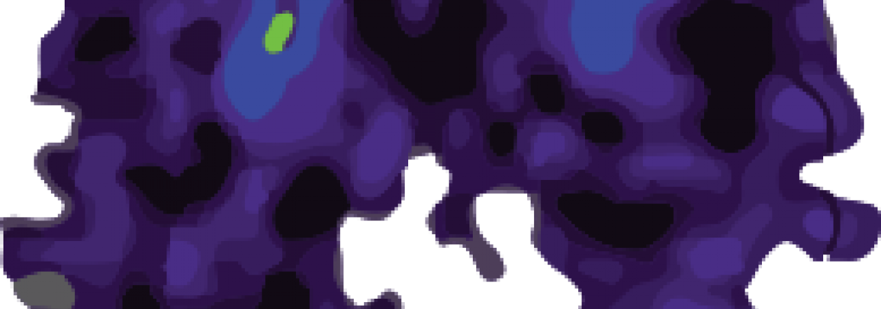 Heat map of the brain.